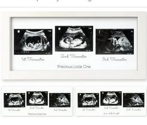 Product Image and Link for KeaBabies Trio Sonogram Picture Frame White