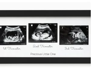 Product Image and Link for KeaBabies Trio Sonogram Picture Frame blk